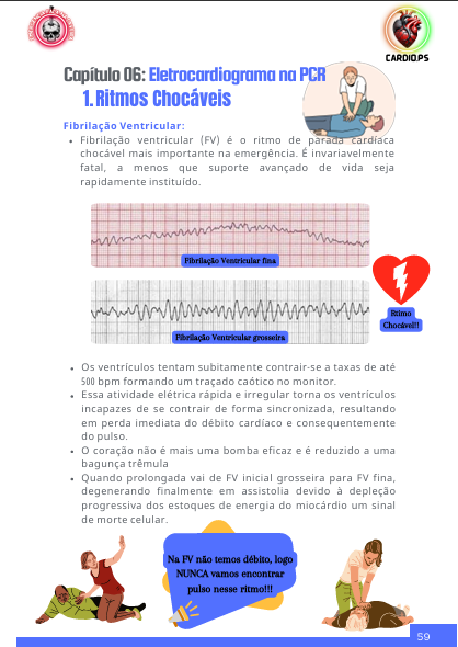 PCR ECG