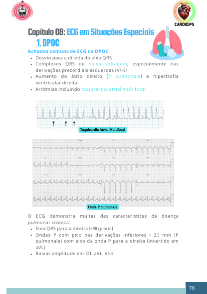 Situações especiais