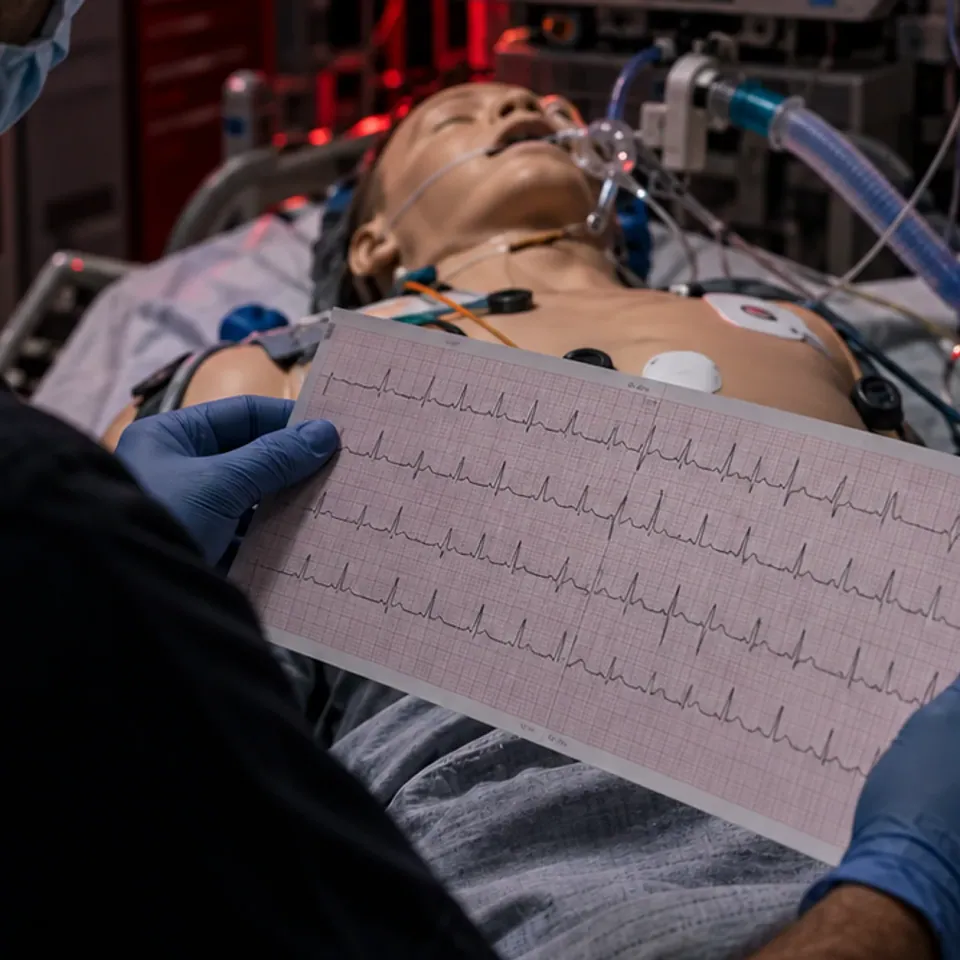 Método PRC na análise do eletrocardiograma